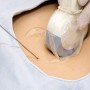 Amniocentesis