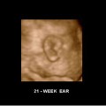 Desarrollo del feto: Semana 21