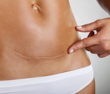 Tus células construyen “puentes” para regenerar la piel