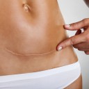 Tus células construyen “puentes” para regenerar la piel