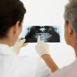 El bruxismo en 10 preguntas