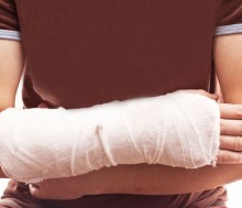 Cuidado si subes con algún hueso fracturado