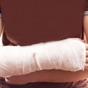 Cuidado si subes con algún hueso fracturado