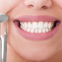 ¿Qué ocurre con los implantes dentales?