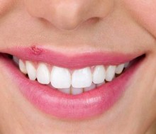 El herpes labial