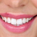 El herpes labial